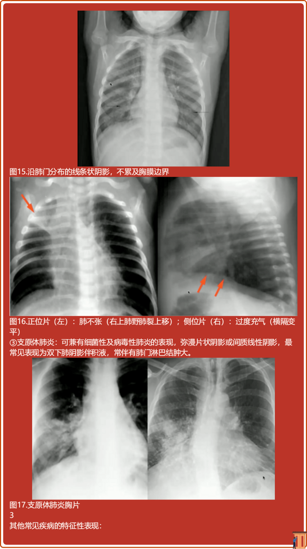 超大胸片曝光图像怎么看超大胸片曝光，透视背后的真相与影响
