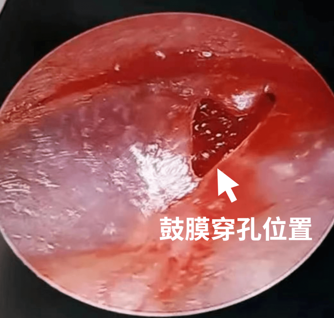 高清学生破外女视频全过程在线播放高清学生遭遇网络侵犯的悲剧，全过程的警示-第2张图片