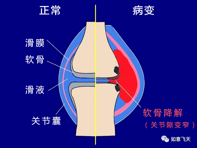 开车40分钟后的身体痛感与异响现象分析-第3张图片