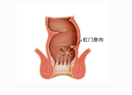 公息肉的魅力，粗大爽快体验的探索-第2张图片
