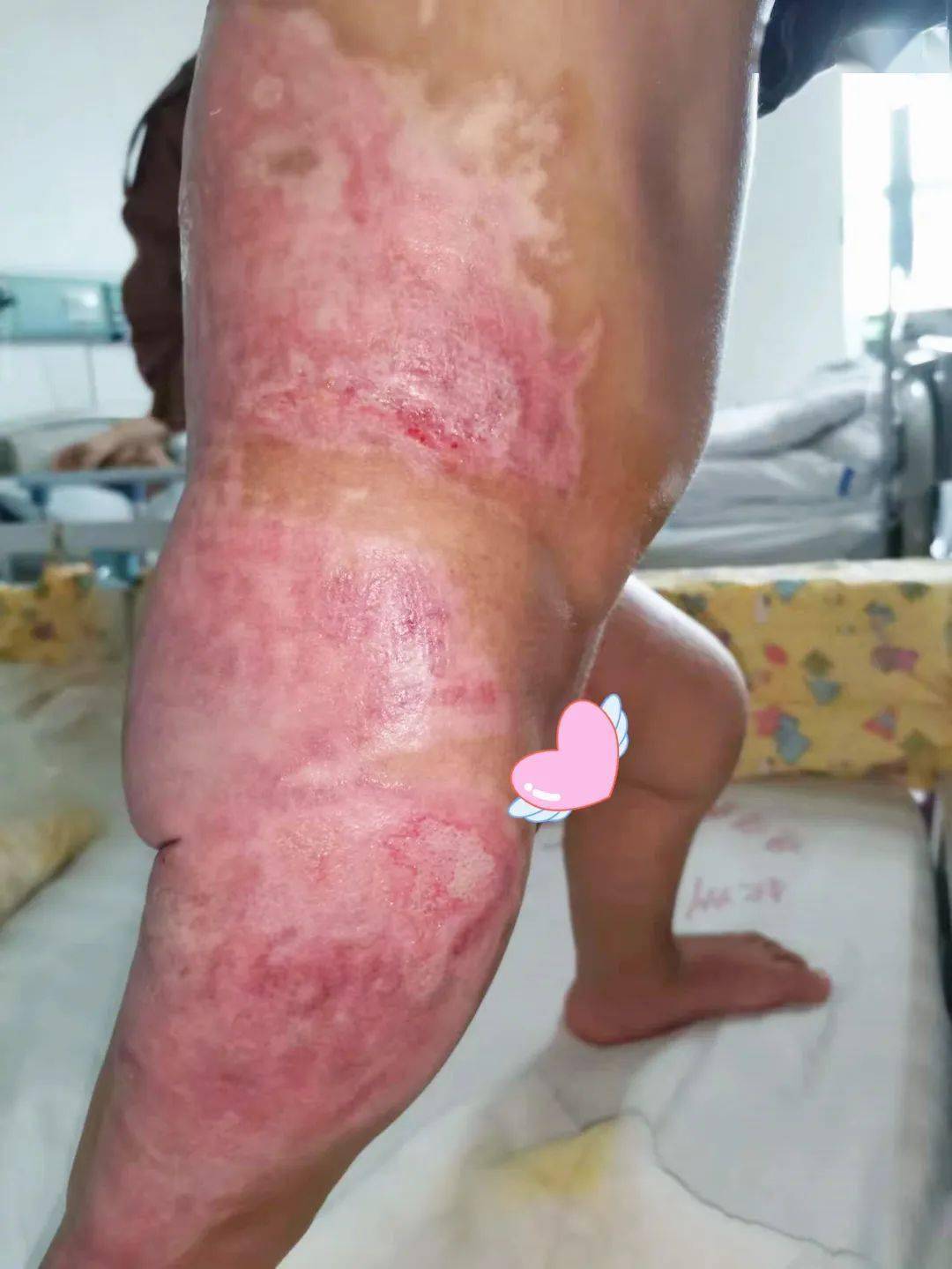 小东西的疏忽，几天未做导致水喷满地