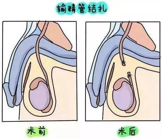女同桌把我的精子弄出来了怎么办面对女同桌意外弄出精子，如何妥善处理？-第2张图片