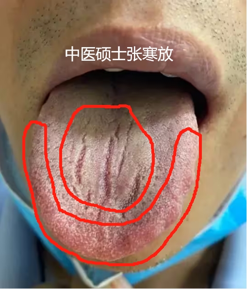 舌头伸入麻麻两腿之间关于舌头与私密空间的探索