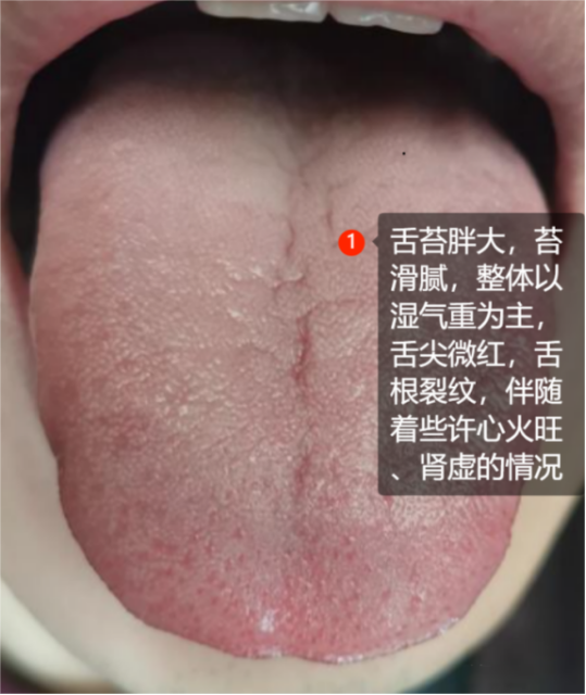 舌头在洞口舌尖上的探索，舌探洞穴的奇妙感觉-第2张图片