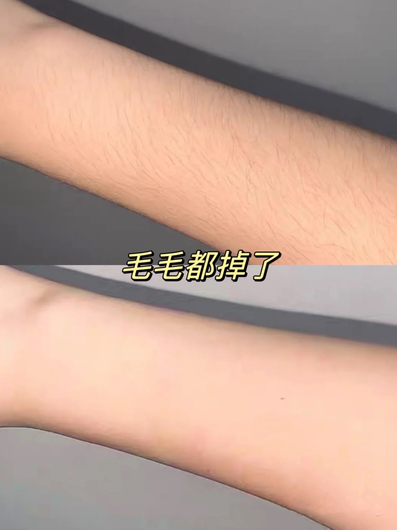 露毛走光现象的探讨与防范-第2张图片