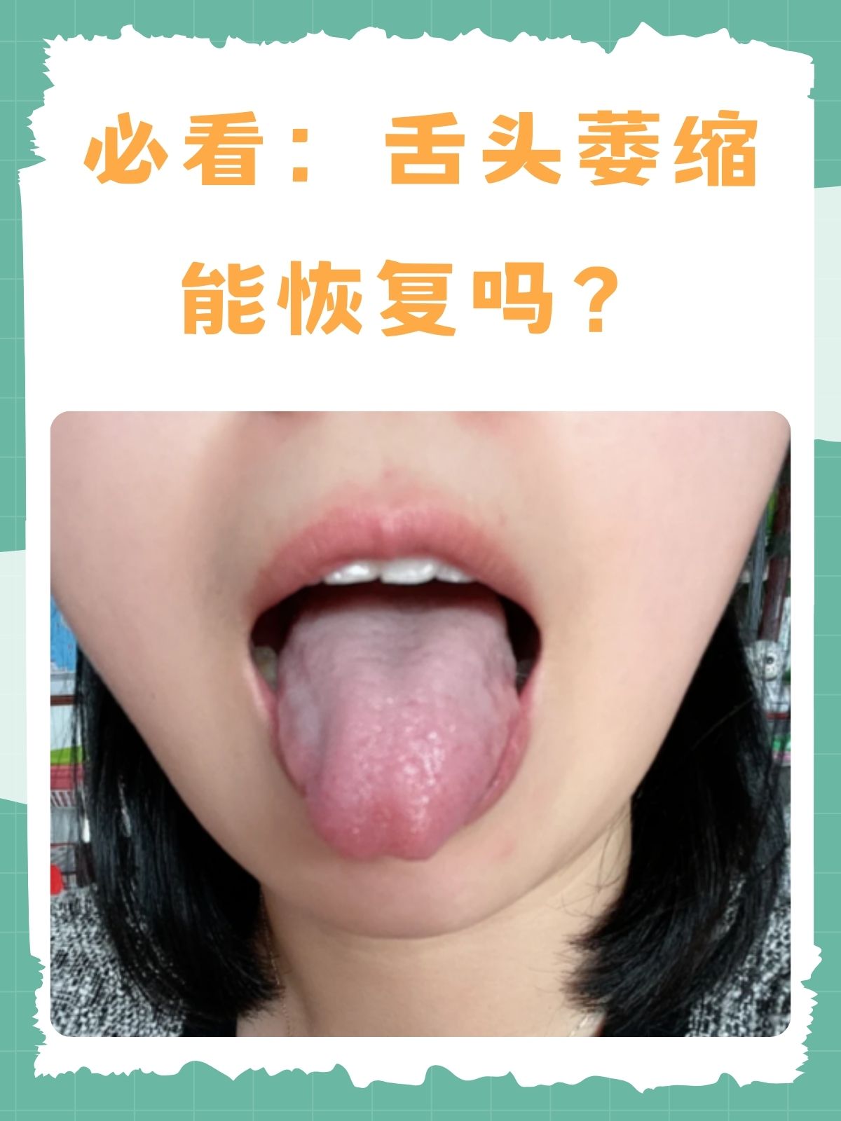 把舌头伸出来呼吸舒服一点正常吗把舌头伸出来，一种独特的呼吸方式