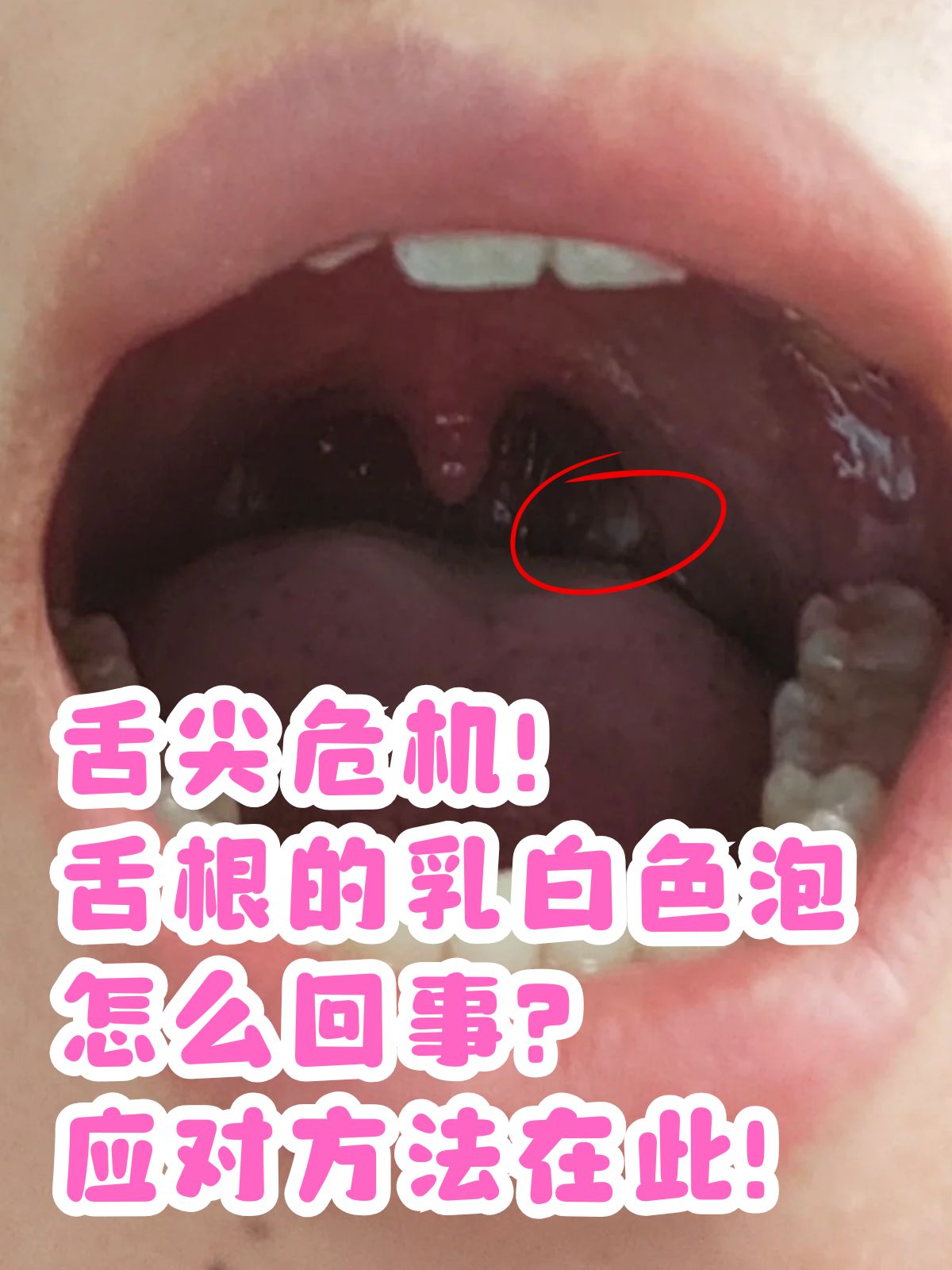 舌头一路向下探是什么病舌尖之旅，舌头的奇妙探索