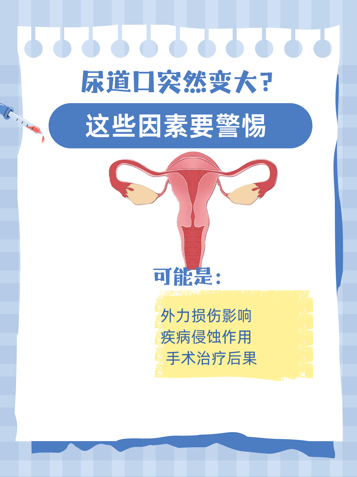 WRITE AS 尿道口尿道口的生理结构与WRITE AS的医学应用