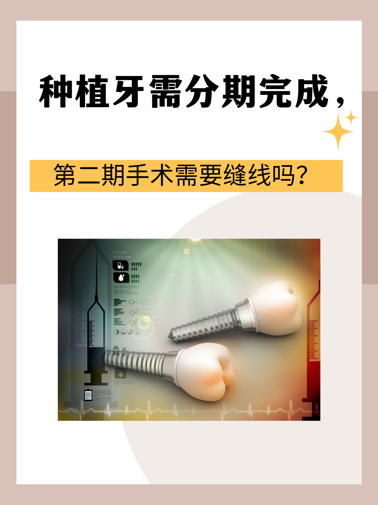 一前一后很好一前一后同时攻击的舒适度探讨