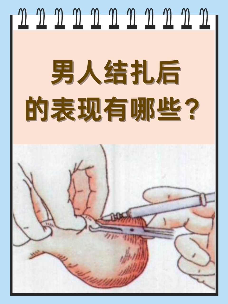 男人又大又硬又粗图片关于男性生理特征的图片探讨-第3张图片