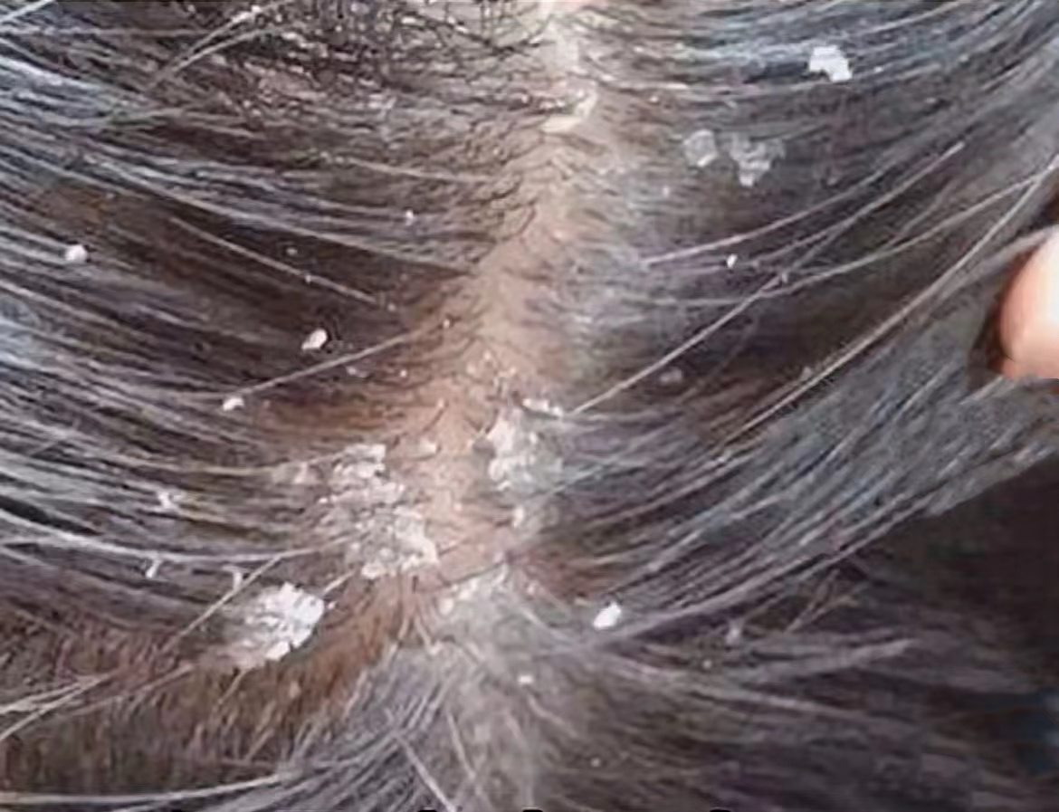 下面一阵一阵的流水怎么回事女生如何通过自我调节提升皮肤状态-第1张图片