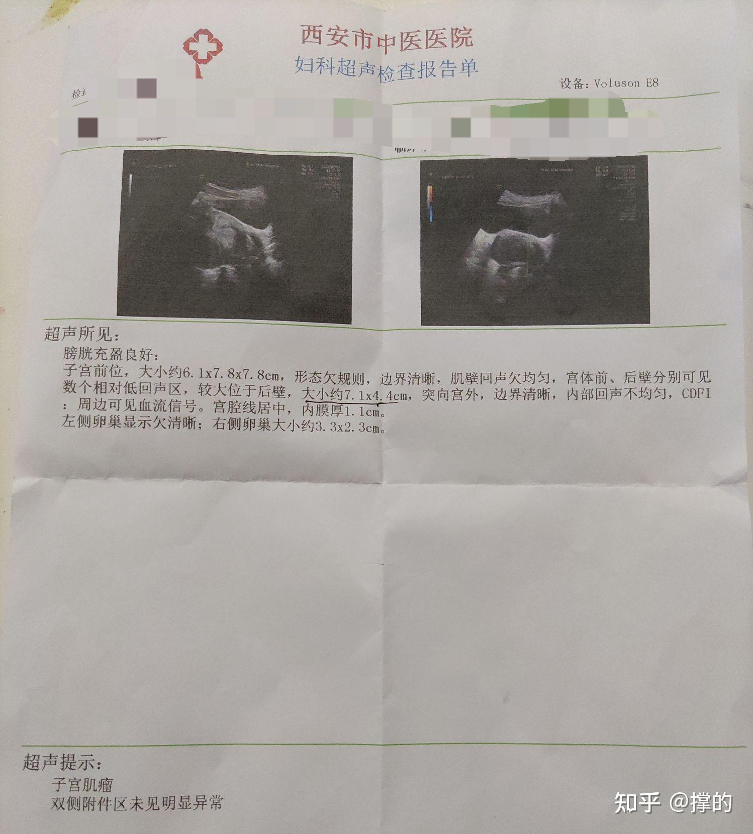 梁医生帮帮忙限季亭亭原文w梁医生，帮帮忙——季亭亭的求医之路