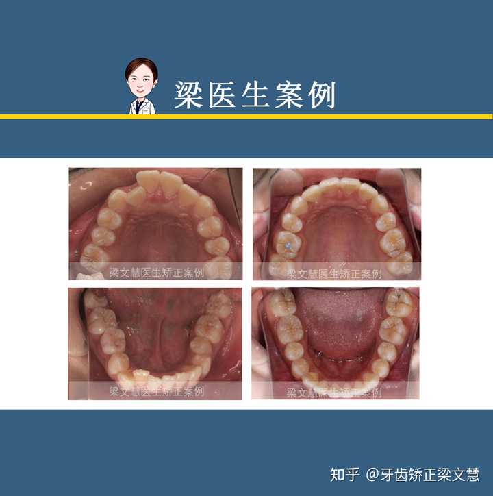 梁医生不可以(限) 季亭亭李斯王月免费阅读梁医生，你的界限——季亭亭与李斯的交织故事-第2张图片