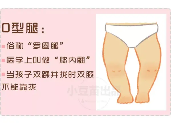 宝宝腿能张开180度宝宝腿位调整，美味扇贝近在咫尺-第1张图片