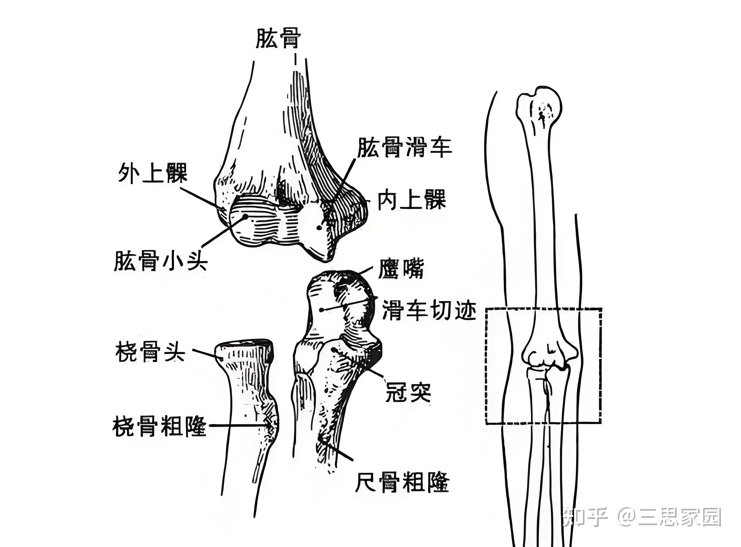 蝴蝶臂是什么原因造成的蝴蝶臂之美，探索与理解