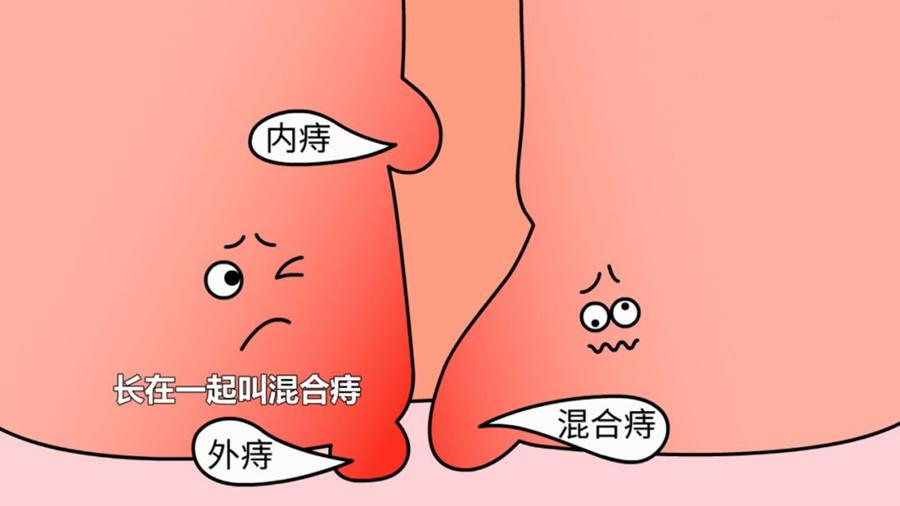 插屁眼关于插屁眼的误解与科学解析