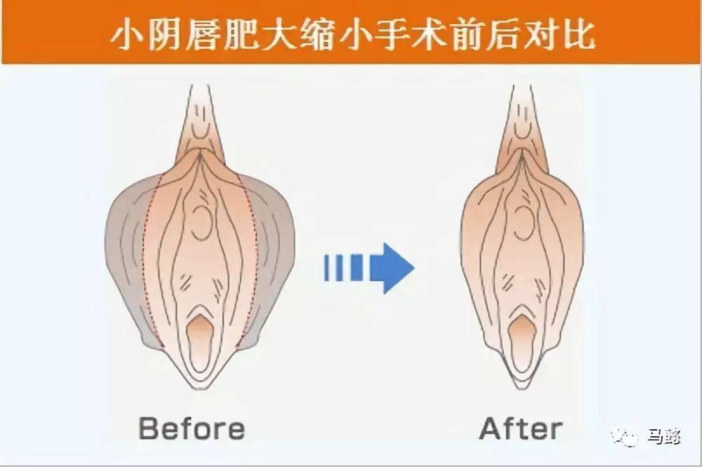 女性角色去掉小内皮肤的软件在女性角色形象与软件技术探讨，关于去除小内皮肤现象的深度解析-第2张图片