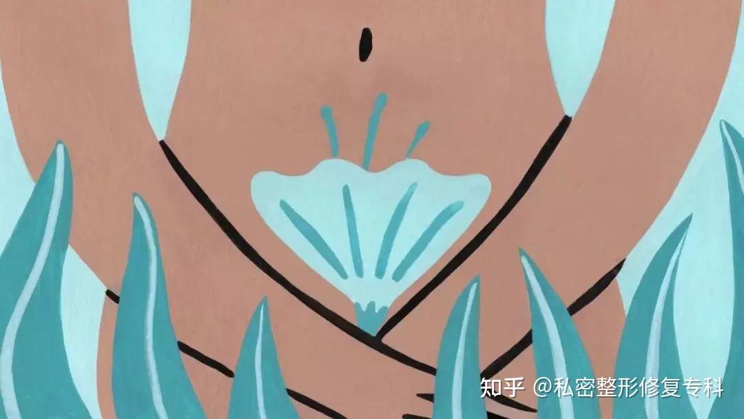 老师下面太紧拔不出来怎么矫如何应对老师私密部位过紧的困扰与矫治方法