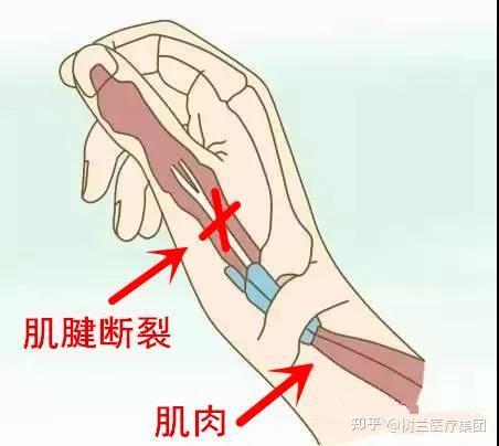 三根手指就受不了了 一会怎么办面对三根手指就受不了了的困境，我们该如何应对？