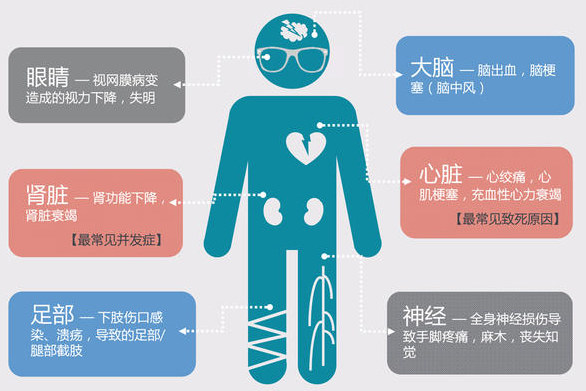 4i是什么意思4i的深层含义解析-第1张图片