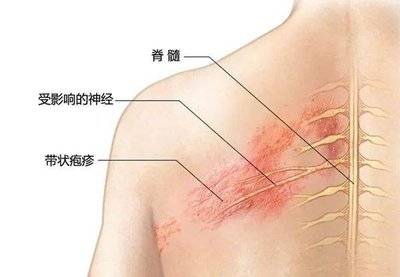 两条蛇根太大了涨的疼蛇根之痛，两条蛇根的巨大困扰