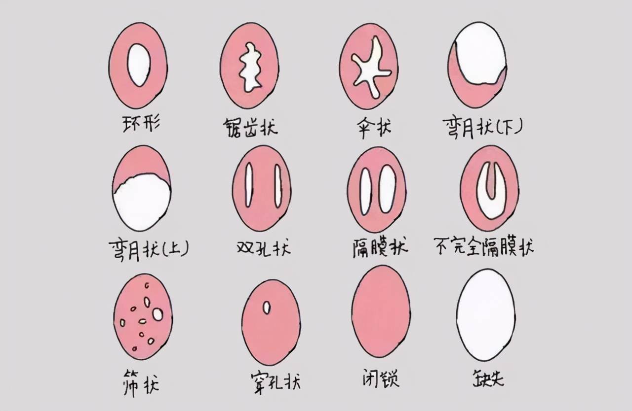 女性生理特征解析，巨大荫蒂勃起现象-第2张图片