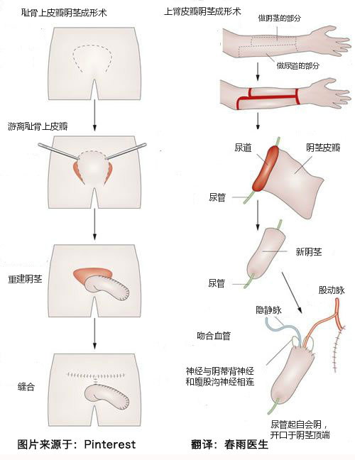 男人喜欢一只手能握满的胸围吗春雨医生男人是否偏爱一只手能握满的胸围？探究背后的心理与文化因素-第2张图片