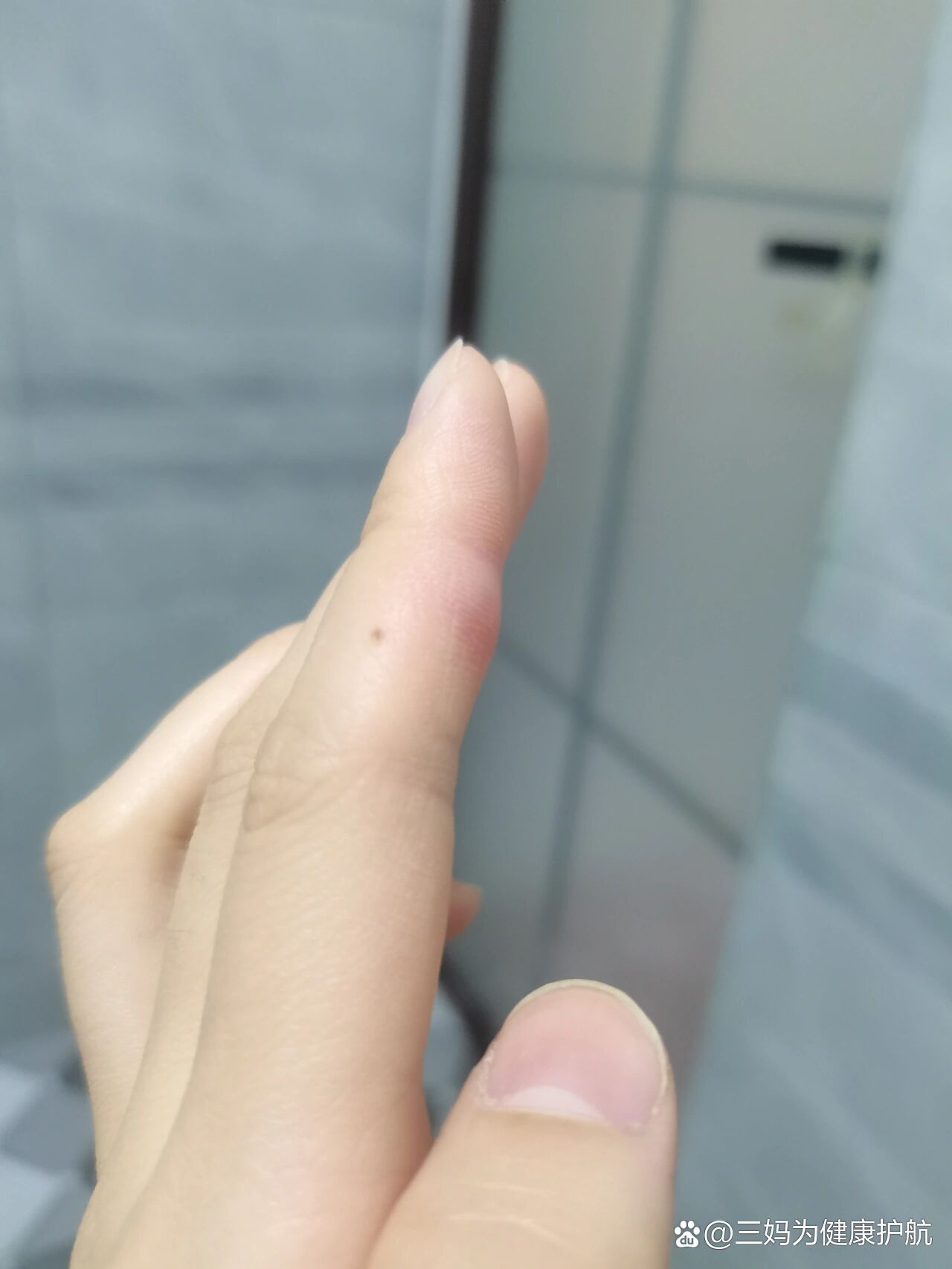 一个手指头就疼成这样视频从微小之处见疼痛——一个手指头就疼成这样的视频启示-第2张图片