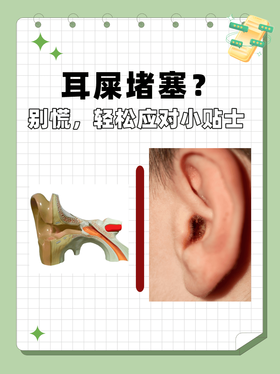 巧妙运用塞子，堵住液体之流