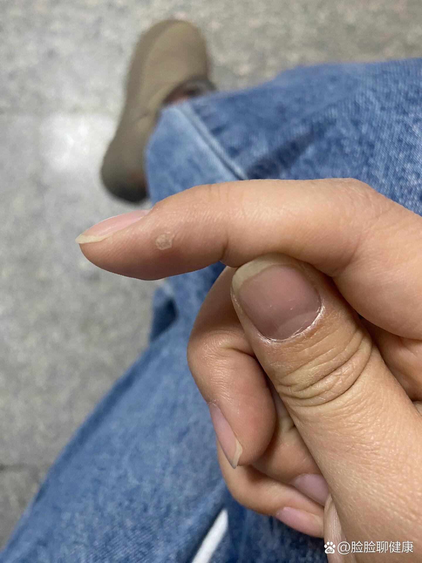一个手指头就疼成这样视频虐一指之痛，从微小细节看身体疼痛的巨大影响——一个手指头就疼成这样视频的启示