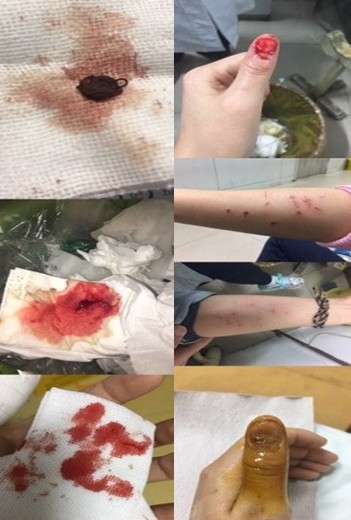 掀衣抓下体女性事件关于掀衣抓下体女性事件的深度分析与思考