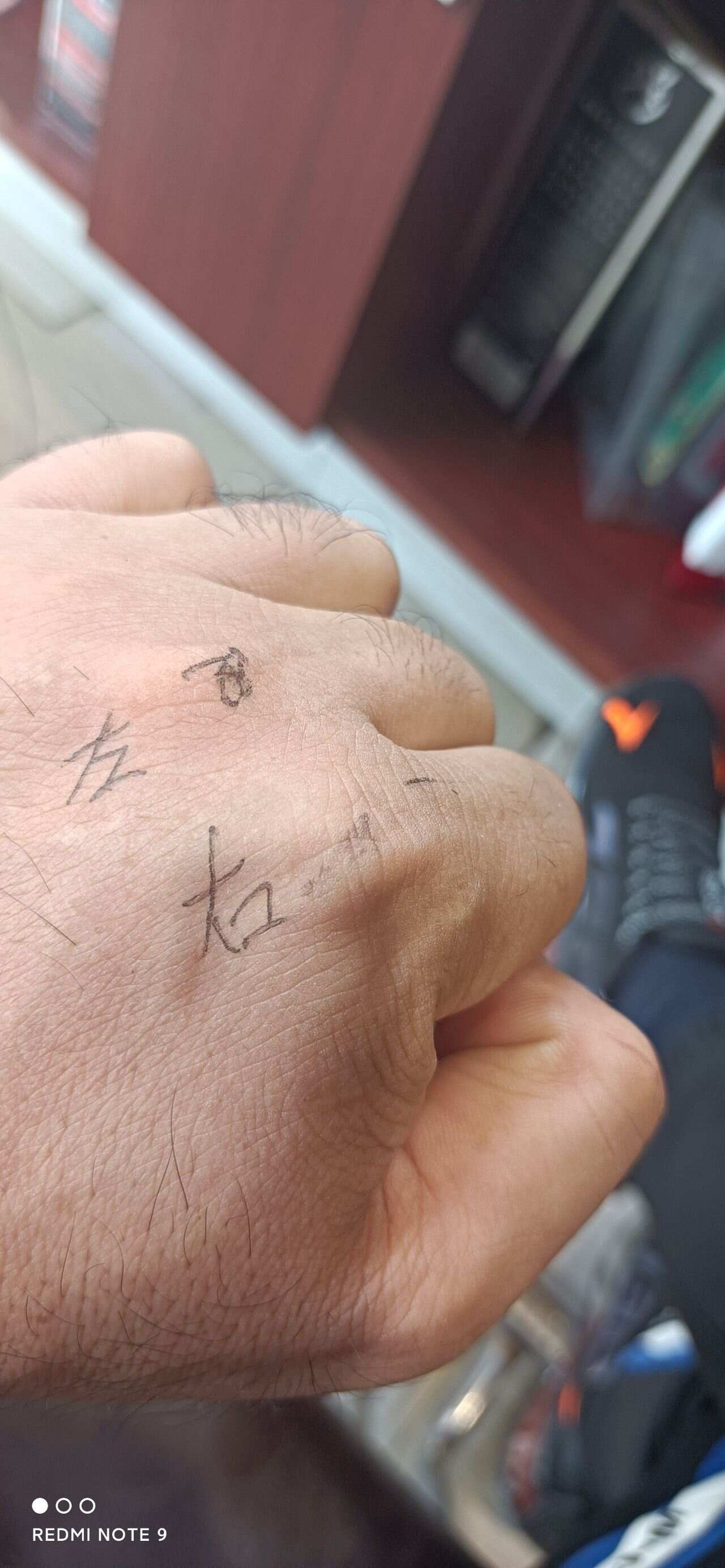 小物之痛，指间之呼声
