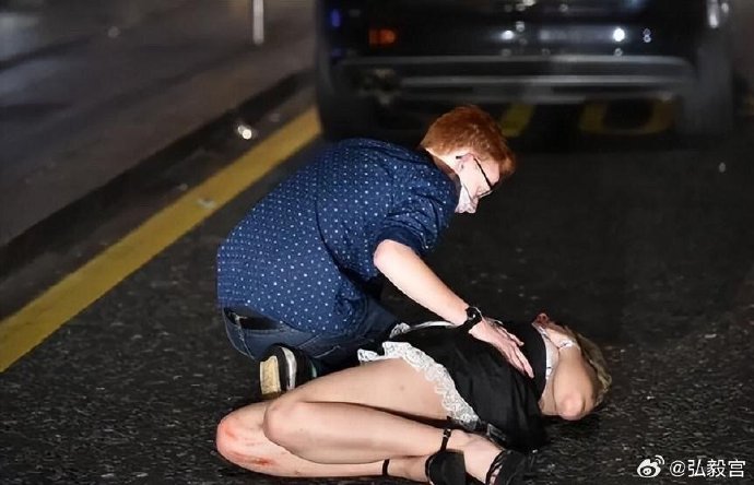 血淋淋的女人真实背后的残酷——血淋淋的伤口与女子的流血