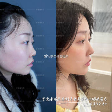 换脸技术，一区二区三区四区的探索与L的奥秘
