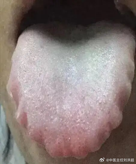 把舌头放屁眼里是感觉不舒服吗探索舌头、放屁与眼中的奇妙感觉-第2张图片