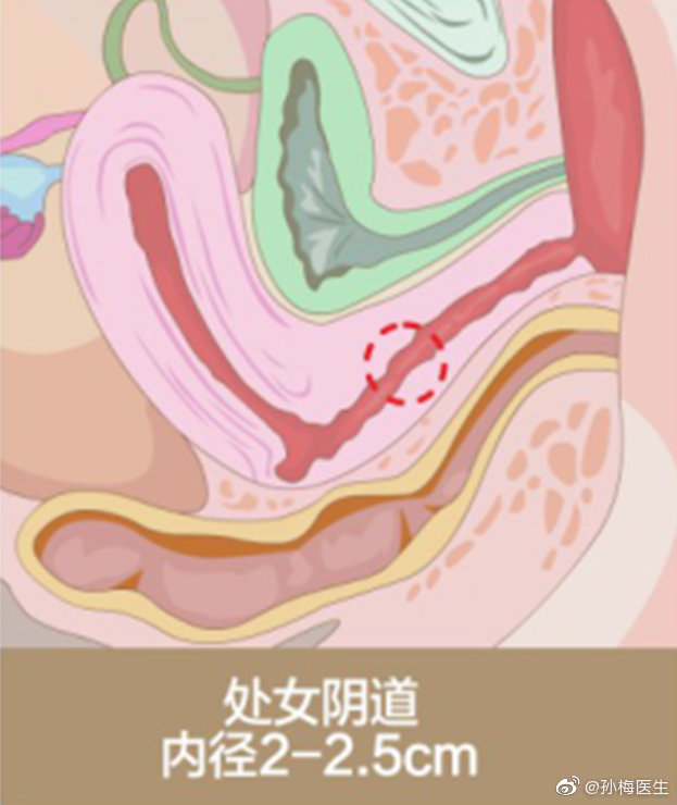 女人阴性道图片真人18关于女性健康与隐私的探讨——不推荐使用或分享涉及私密部位的图片-第2张图片