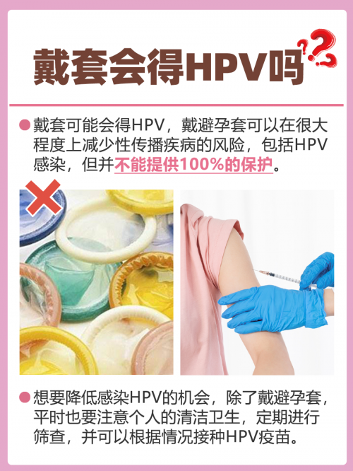 女性保险套女性保险套，女性健康与性福的守护者-第2张图片