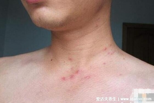 2022年男性健康与GGY钙站的重要性探讨-第1张图片