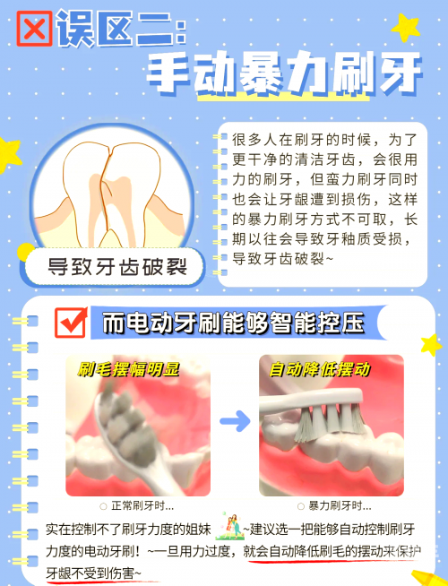 电动牙刷怎么惩罚自己电动牙刷的惩罚使用方式-第3张图片