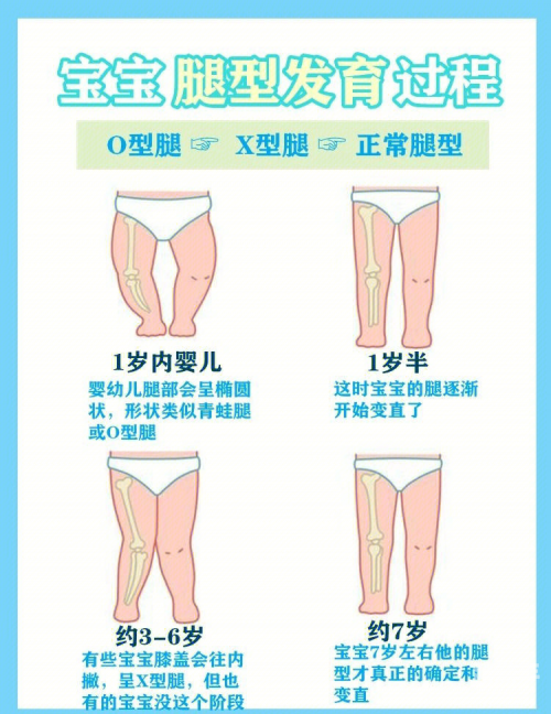 宝宝双腿交叉使劲用力什么症状啊宝宝双腿交叉使劲用力的症状解析-第2张图片