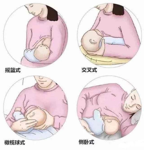 宝宝双腿交叉使劲用力什么症状啊宝宝双腿交叉使劲用力的症状解析-第3张图片