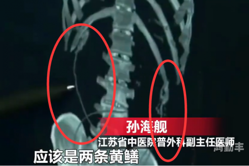 黄鳝门女主角是叫什么黄鳝门事件与百度云资源链接的探讨-第2张图片