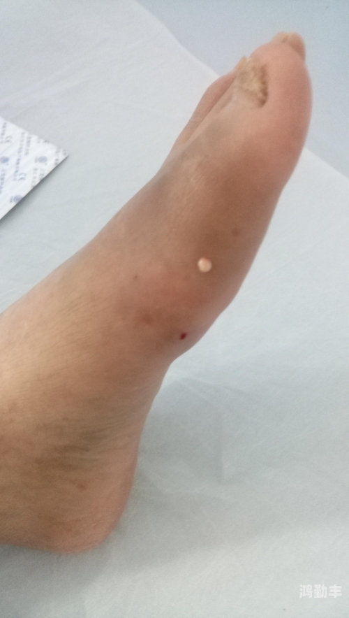 打扑克时流出来的白色液体是什么?打扑克时流出的白色液体解析-第1张图片