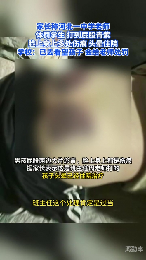 体罚打屁屁体罚与打屁屁，教育中的误区与影响