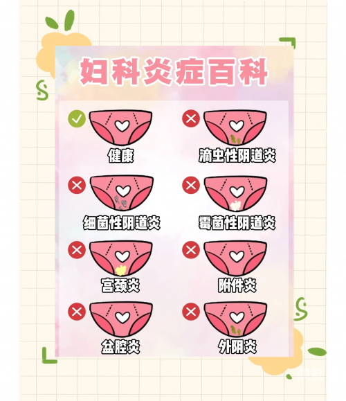 女人下边水润紧致好处女性私密健康之水润紧致的好处