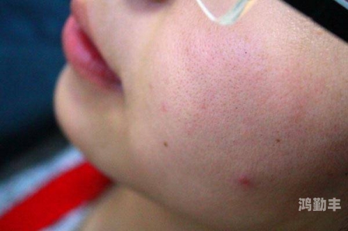 女人睡觉双腿叉开体重下降女人睡觉姿势与体重下降之谜，双腿叉开睡姿的秘密
